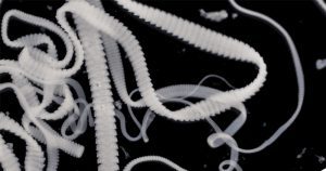 พยาธิตัวตืดหมูและวัว (Tapeworm) สาเหตุการเกิดโรคและอาการ