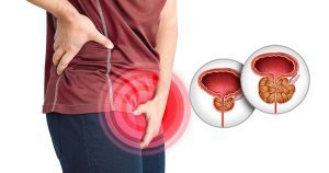 Benign Prostatic Hyperplasia
