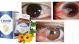 Vistorite คืออะไร – ราคา – ดีไหม – วิธีใช้ – รีวิว- Pantip