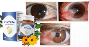 Vistorite คืออะไร – ราคา – ดีไหม – วิธีใช้ – รีวิว- Pantip