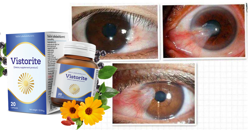 Vistorite คืออะไร – ราคา – ดีไหม – วิธีใช้ – รีวิว- Pantip
