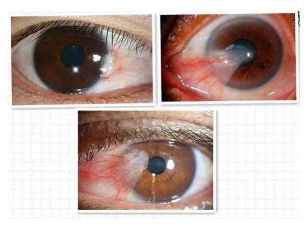 Vistorite ดีจริงไหม – ราคาเท่าไร – มีขายที่ไหน – รีวิวผู้ใช้ – Pantip ว่าไงบ้าง