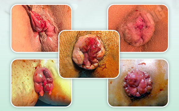 Pilonix (ไพโลนิกซ์)