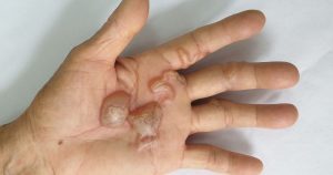 ทำไมคนไทยจำนวนมากเลือกใช้ Extera