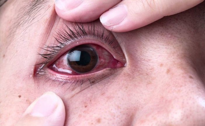 Philola เหมาะกับใครบ้าง